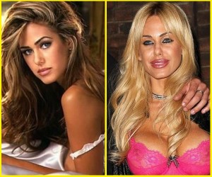 shauna-sand-plastic-surgery-before-and-after